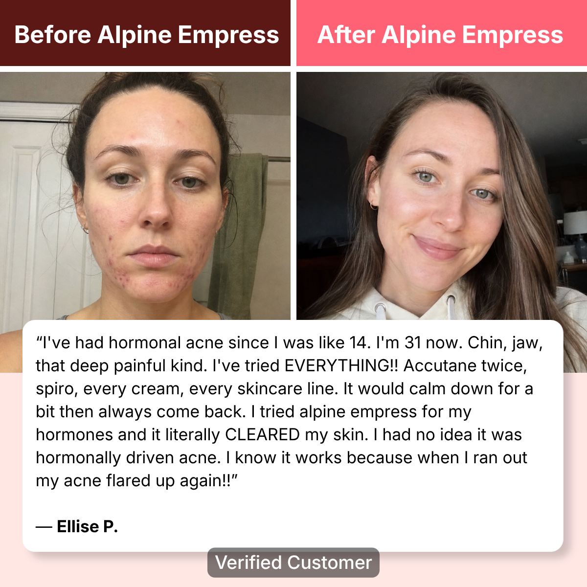 Alpine Empress Resilience Kit